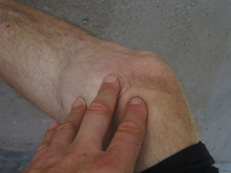 Radfahren gegen Arthrose im Kniegelenk – Sport gegen Osteoarthritis