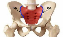 ISG Blockade