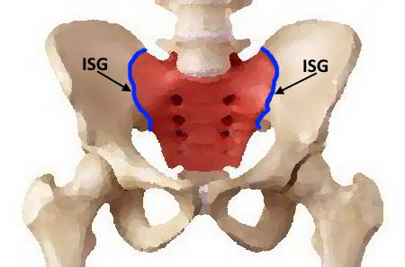 ISG Blockade – Schmerzen im Iliosakralgelenk verhindern